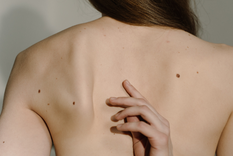 En Argentina, se diagnostican 1.700 casos de este tipo de cáncer por año, pero es uno de los tumores más peligrosos Foto: archivo.