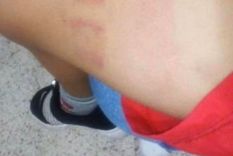 salio a correr a pesar de la prohibicion, la detuvieron y denuncia brutalidad policial