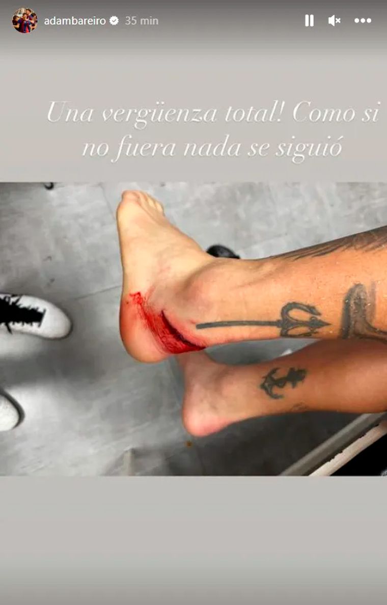 La historia que subió Bareiro luego del pisotón. La historia que subió Bareiro luego del pisotón.
