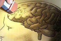 Cada tres segundos, alguien desarrolla una demencia. Foto: MDZ