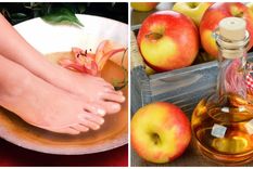 Vinagre de manzana y bicarbonato de sodio, dos elementos que frenan la formación de hongos y bacterias en los pies. Foto: Mejor con salud (mejorconsalud.as.com)