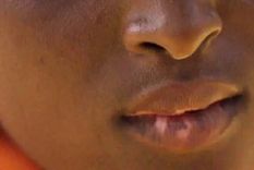 Una mujer nigeriana relató a la BBC los problemas de salud que presentan sus hijos por su decisión de intentar blanquearles la piel. Foto: BBC Mundo