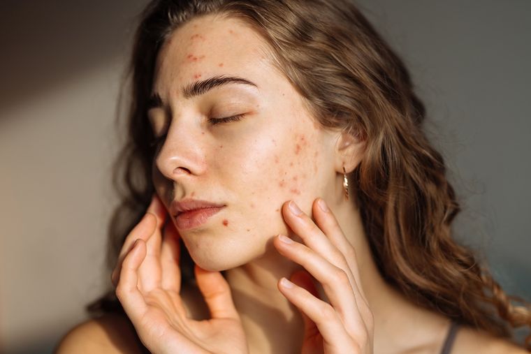 Con la nueva función, los usuarios podrán corregir imperfecciones faciales en cuestión de segundos. Con la nueva función, los usuarios podrán corregir imperfecciones faciales en cuestión de segundos.