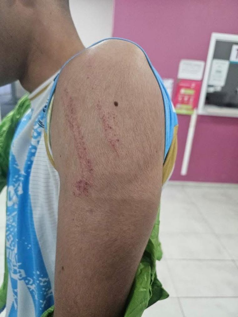 Cuatro futbolistas de La Dormida terminaron con distintas heridas. Cuatro futbolistas de La Dormida terminaron con distintas heridas.