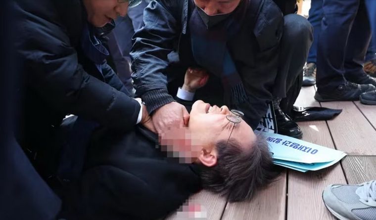 Lee es atendido, luego de sufrir el ataque en un acto público. Foto: Efe.