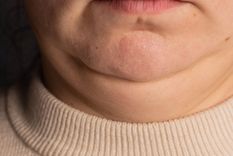 Si tu cuello se ve más grueso o más delgado de lo habitual, puede indicar algunos problemas de salud.