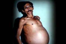 pensaron que tenia un tumor pero se llevaron una sorpresa