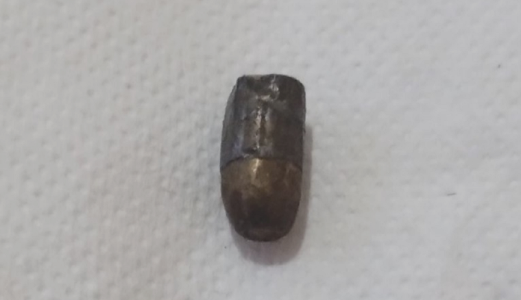 El proyectil hallado en una de las empanadas Foto: NA