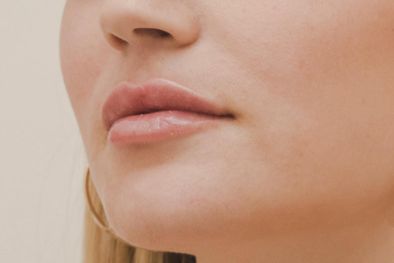 MDZol | Así podría lucir tu boca después de este tratamiento. Foto: Flai Fotografía