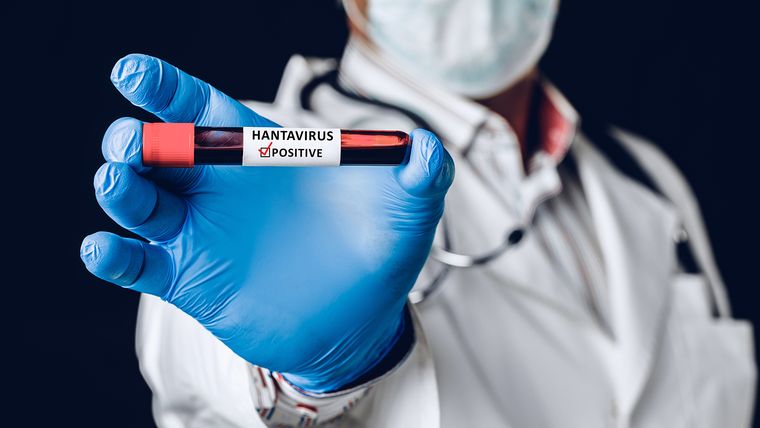 El hantavirus es una enfermedad viral.