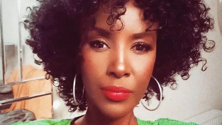 A Isser le dijeron que un lunar que le habían quitado era en realidad cáncer de piel. Foto: ISSER NENER