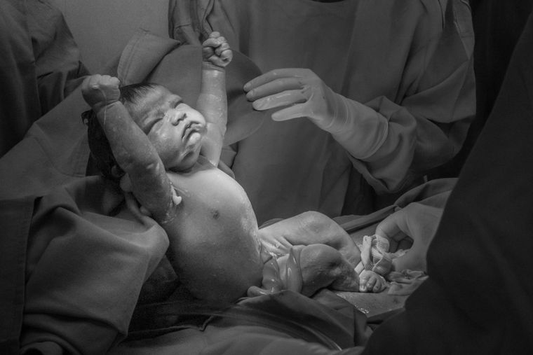 La defensa de la vida. Foto: Nora Dalmasso