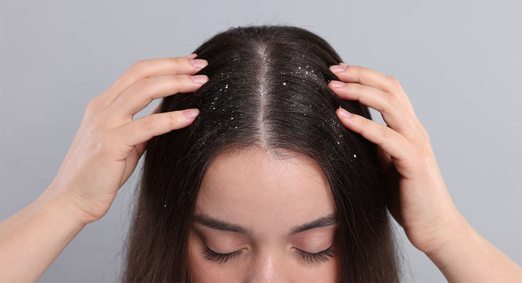 Este tratamiento, aplicado de manera constante, elimina el hongo y mejora el estado del cabello. Foto: Archivo