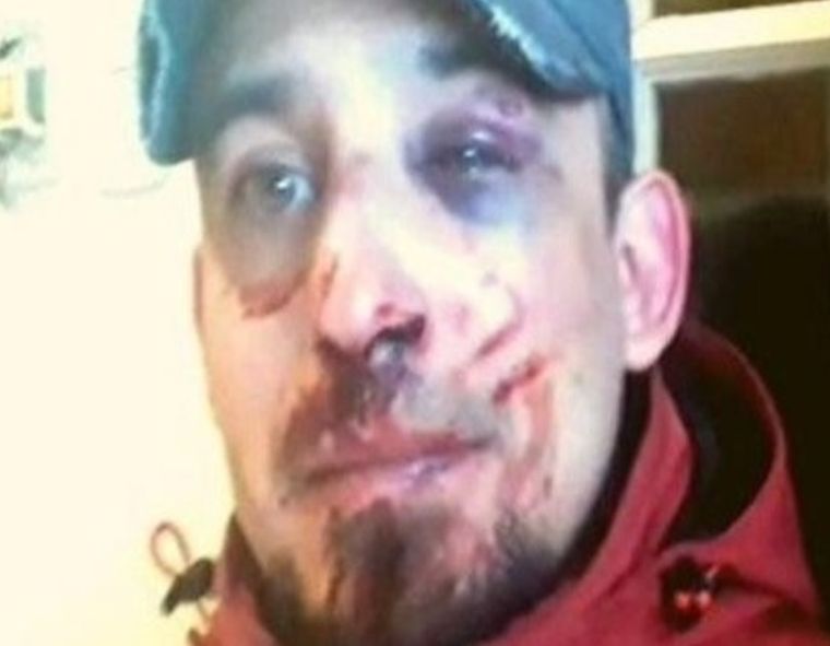 El hombre terminó con fracturas en el tabique, lesiones en un ojo y dientes partidos