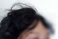 Cobarde ataque La mujer avisó que estaba en riesgo, pero la Ley llegó tarde.