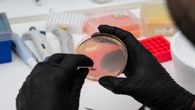 El proyecto recibirá un apoyo financiero de 330 mil dólares por dos años El proyecto recibirá un apoyo financiero de 330 mil dólares por dos años