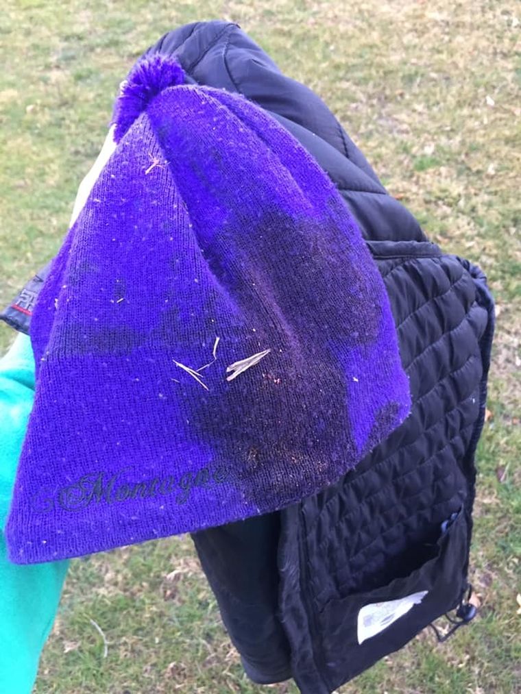 Sangre Así quedó la ropa del hombre: toda ensangrentada.