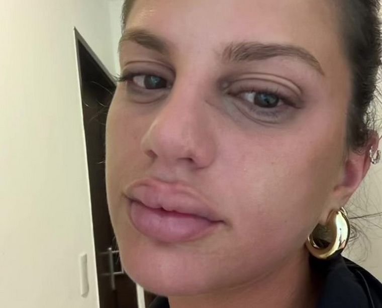 Una tiktoker se hizo viral luego de contar por las redes sociales que quedó internada por comer una conocida golosina que compró suelta en un kiosco. Foto: Captura de video