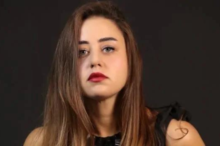 LA ESTRELLA DE HERCAI CAMBIÓ ROTUNDAMENTE. LA JOVEN ACTRIZ SE SOMETIÓ A TODO UN PROCESO PARA SI TRANSFORMACIÓN