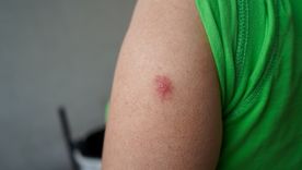 El barigüí suele aparecer cerca de ríos y arroyos durante los meses de calor.