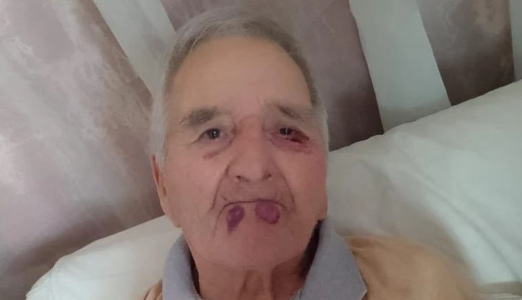 Las lesiones visibles en el rostro de Héctor Salas. Las lesiones visibles en el rostro de Héctor Salas.