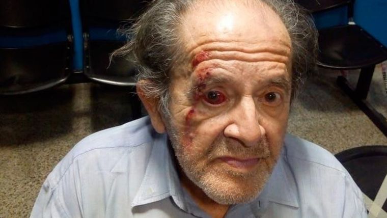 El hombre golpeado por el guardia había sido operado de columna y por eso necesitaba trasladar las compras en el carrito