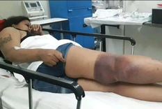 Así quedó la mujer tras recibir la descarga eléctrica