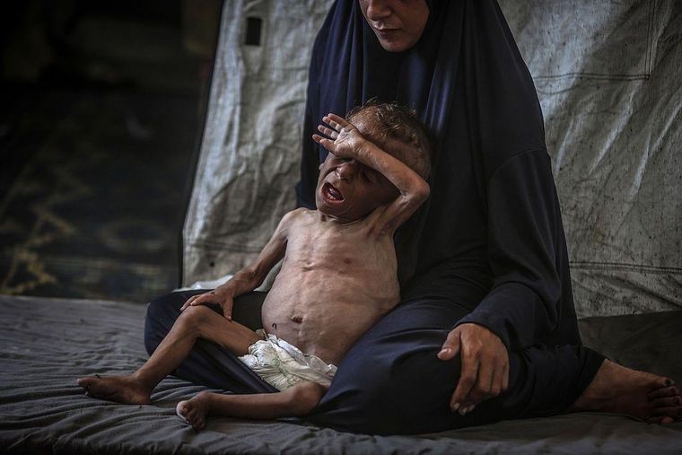 Niños en Gaza están muriendo por desnutrición.
