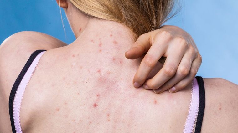 Foto: https://laopinion.com/