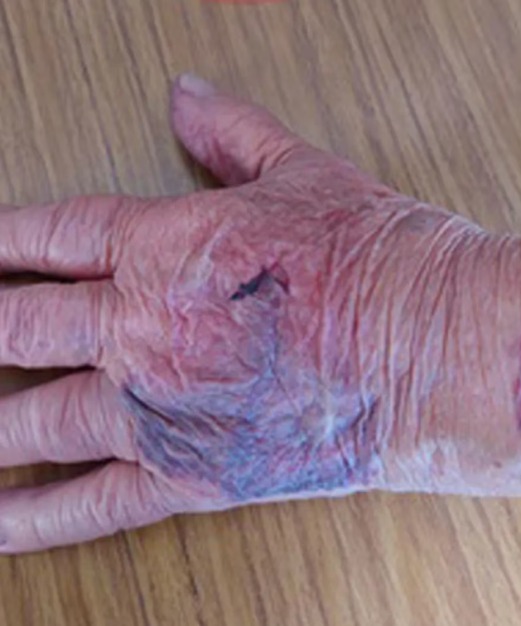 Así dejaron los delincuentes a una de las víctimas