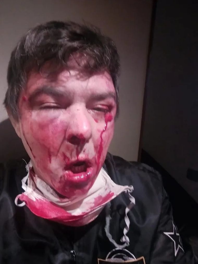 Asi quedó el encargado del edificio tras el ataque