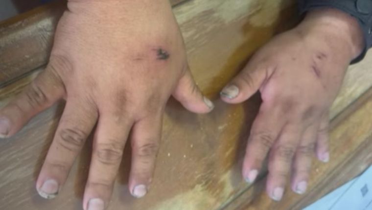 A partir de la inspección en sus manos, se remitieron muestras tomadas debajo de las uñas del acusado para ser cotejadas con el ADN de las víctimas.