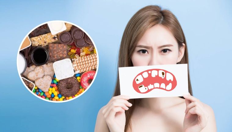 Los alimentos que atentan contra tus dientes (Shutterstock).