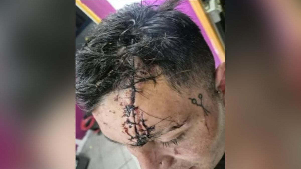 Pactó una cita y despertó con 90 puntos de sutura: investigan un caso de viuda negra