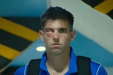 EL ojo de Altamirano tras el golpe. Foto: Captura EL ojo de Altamirano tras el golpe. Foto: Captura