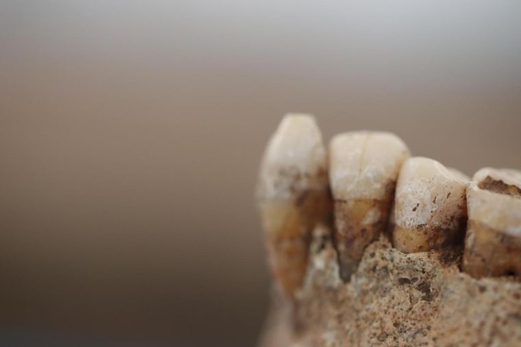 Unos dientes de hace 4.000 años revelan detalles sobre la evolución de la dieta humana Foto: Yahoo