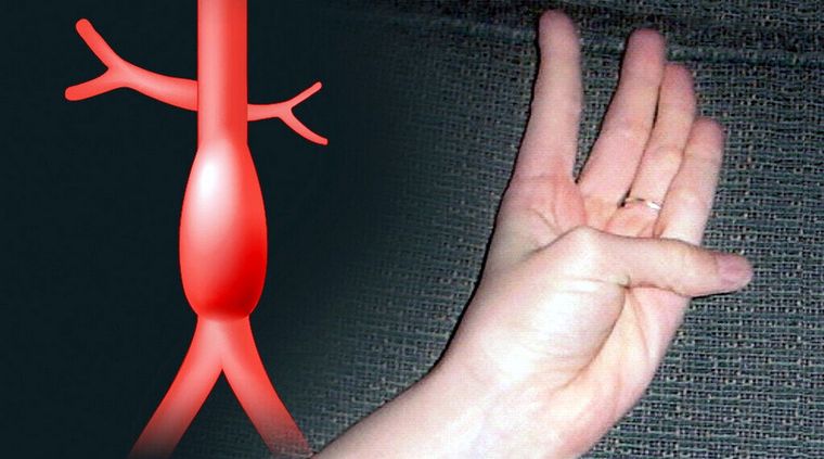 El test. Foto: MedicalXpress.