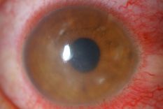 descubren una nueva parte del cuerpo humano