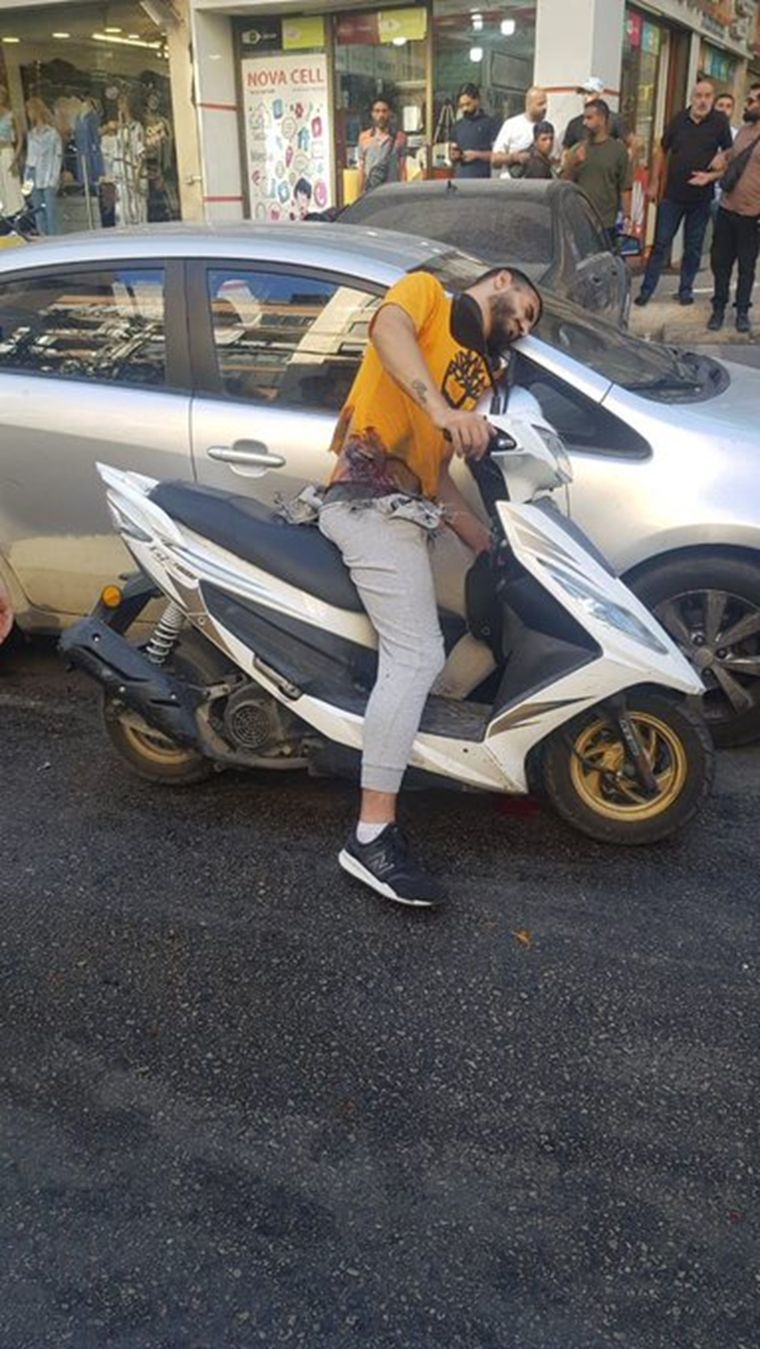 Uno de los heridos en Líbano tras explotar el beeper en su cintura Foto: X