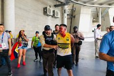 Un hincha colombiano ensangrentado. Foto: Gentileza Fernando Ariel Un hincha colombiano ensangrentado. Foto: Gentileza Fernando Ariel