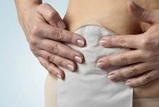 pocas provincias cubren el tratamiento obligatorio para ostomizados