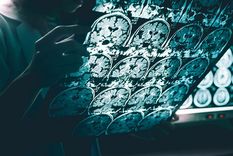 por primera vez un medicamento contra el alzheimer mostro buenos resultados