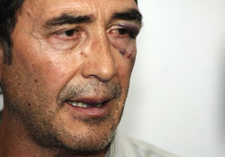 Un legislador dijo ser golpeado, otros aseguran que él golpeó. Foto: Pachy Reynoso/MDZ
