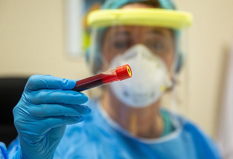 Una muestra de sangre para una prueba de anticuerpos del covid-19.