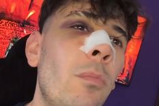 El joven recibió una brutal golpiza a la salida del boliche, que lo dejó con graves heridas en el rostro y parte del cuerpo.