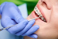 Detectaron brackets falsificados en Chaco y Córdoba: la Anmat ordenó su prohibición en todo el país. Foto: Shutterstock