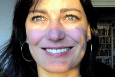 Detrás de mi cara hinchada pude ver que seis de mis dientes frontales ya no estaban: la pesadilla de mi sonrisa perfecta