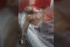 El Sandrito, internado en el Hospital Carrillo luego de ser detenido tras una persecución en Las Heras. (Se pixela el rostro porque puede pasar a rueda de personas)