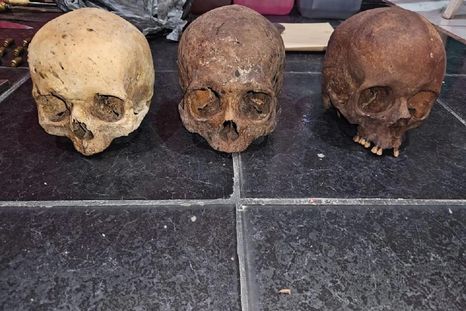 Un médico legista certificó que se trata de cráneos humanos, por lo cual fueron trasladados a la Morgue Judicial Foto: NA