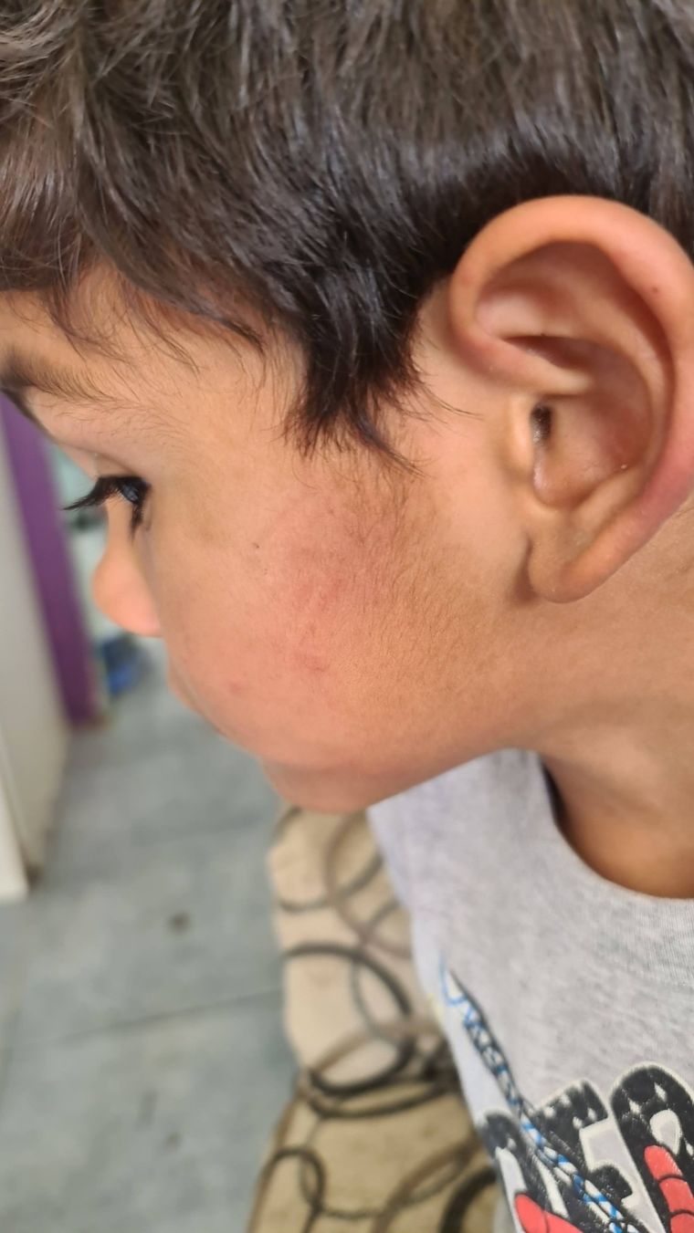 La mujer denunció que la madre biológica maltrataba al pequeño de 4 años. La mujer denunció que la madre biológica maltrataba al pequeño de 4 años.